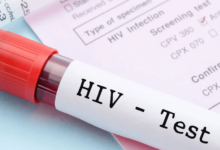 How Quick HIV Screening Dubai Helps You Take Control of Your Sexual Health
