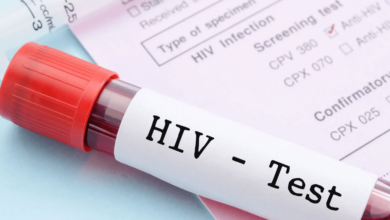 How Quick HIV Screening Dubai Helps You Take Control of Your Sexual Health